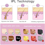 جهاز IPL لإزالة الشعر بالليزر في المنزل – نتائج دائمة بدون ألم | لجميع مناطق الجسم